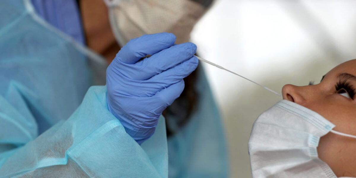 Obavje tenje pcr testiranje